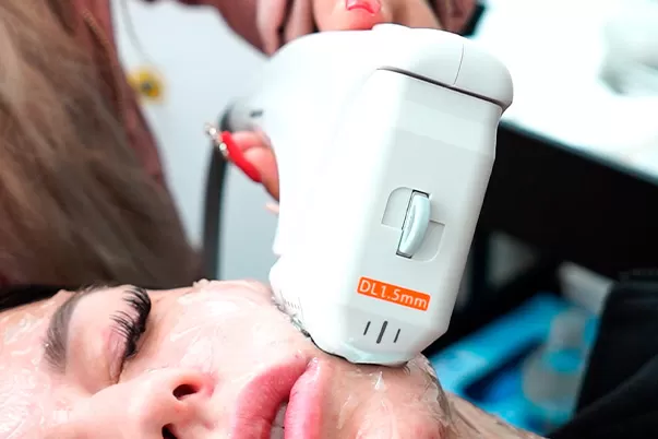 Tratamiento HIFU Cuello y Escote en Vive Medical Spa