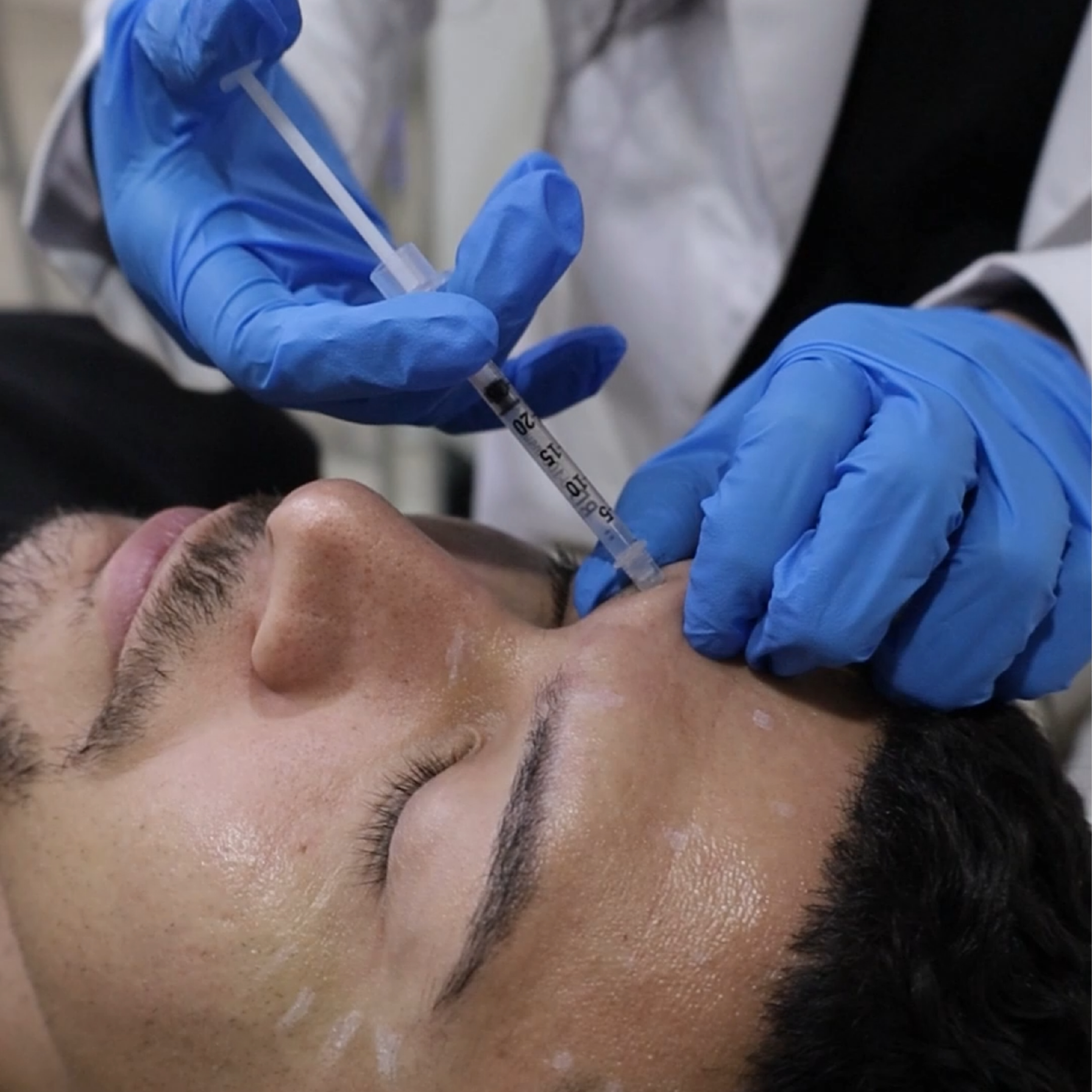 Tecnología Láser en Vive Medical Spa