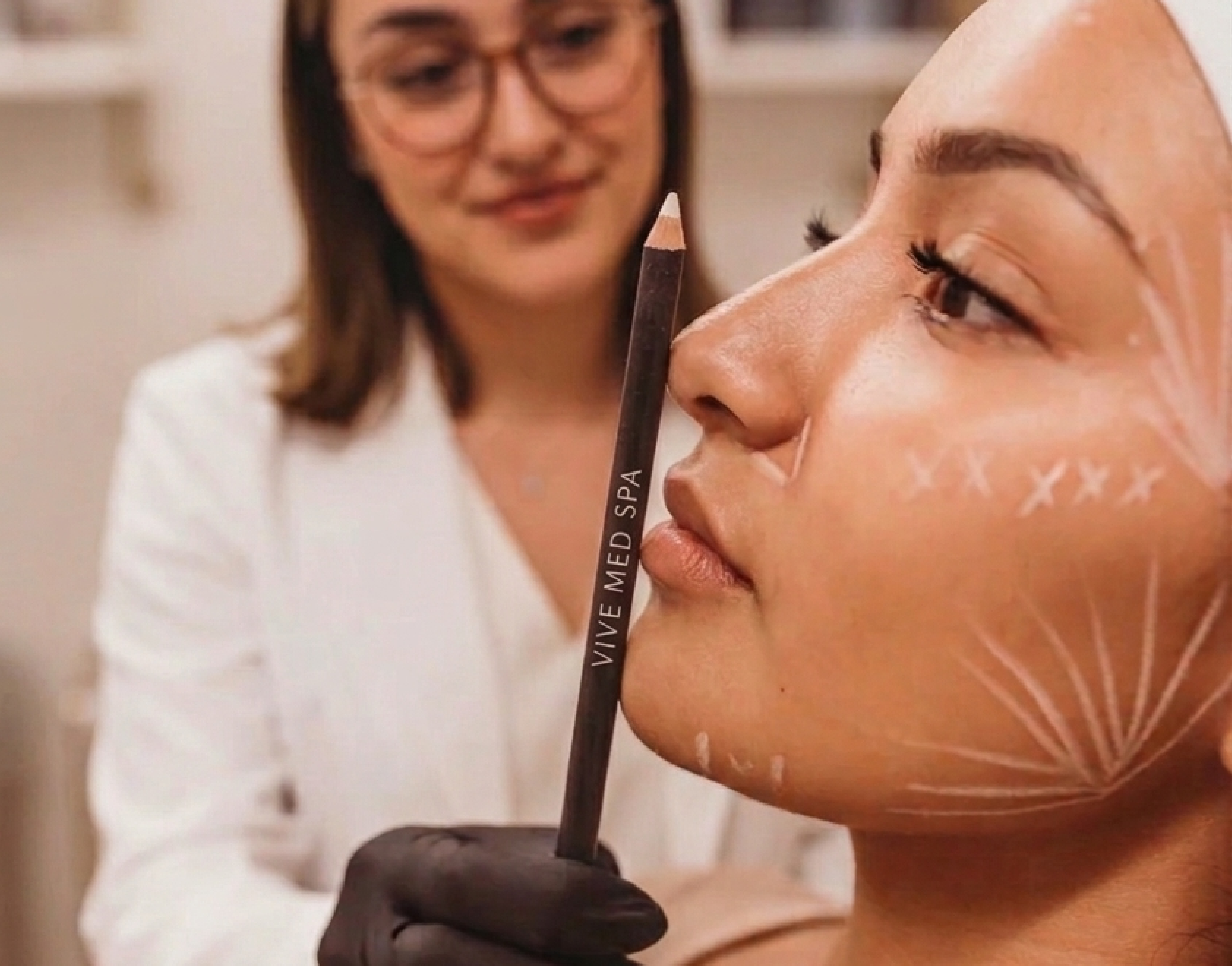 Aumento de mentón en Tijuana - Realce no quirúrgico de mentón en Vive Med Spa