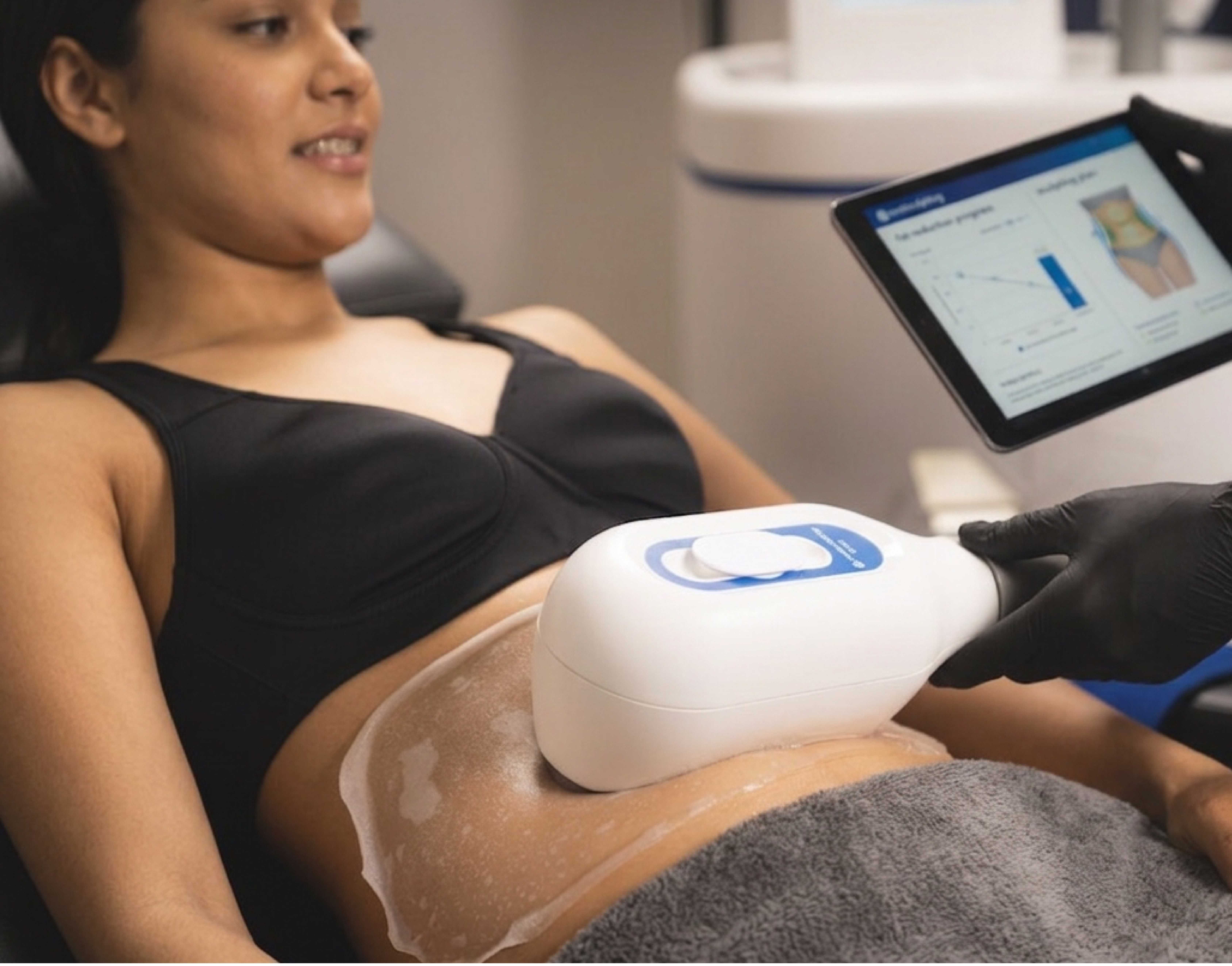 CoolSculpting treatment at Vive Medical Spa in Tijuana