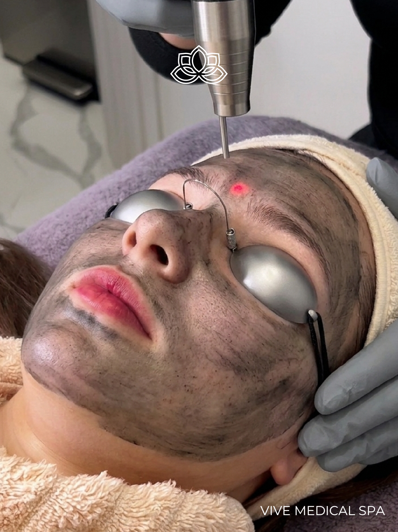 Resultados del Hollywood Peel en Vive Med Spa