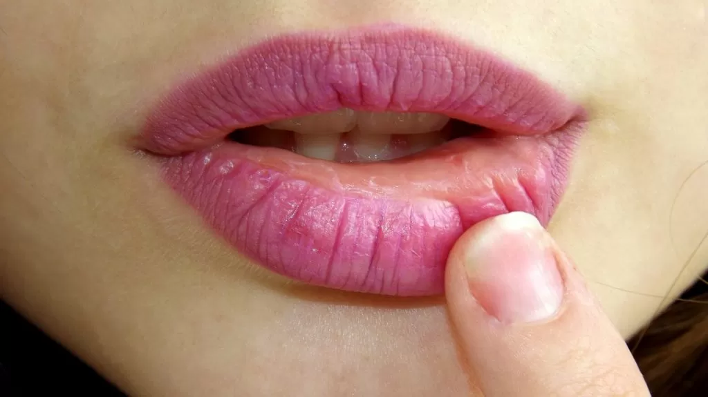 lips-8 - Vive Spa Medico Tijuana Mexico