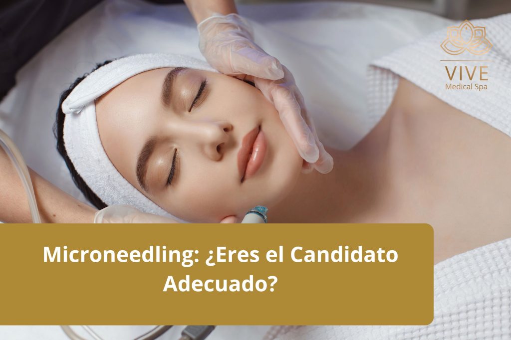 Paciente recibiendo tratamiento de microneedling en Vive Medical Spa Tijuana para mejorar la salud y apariencia de la piel.