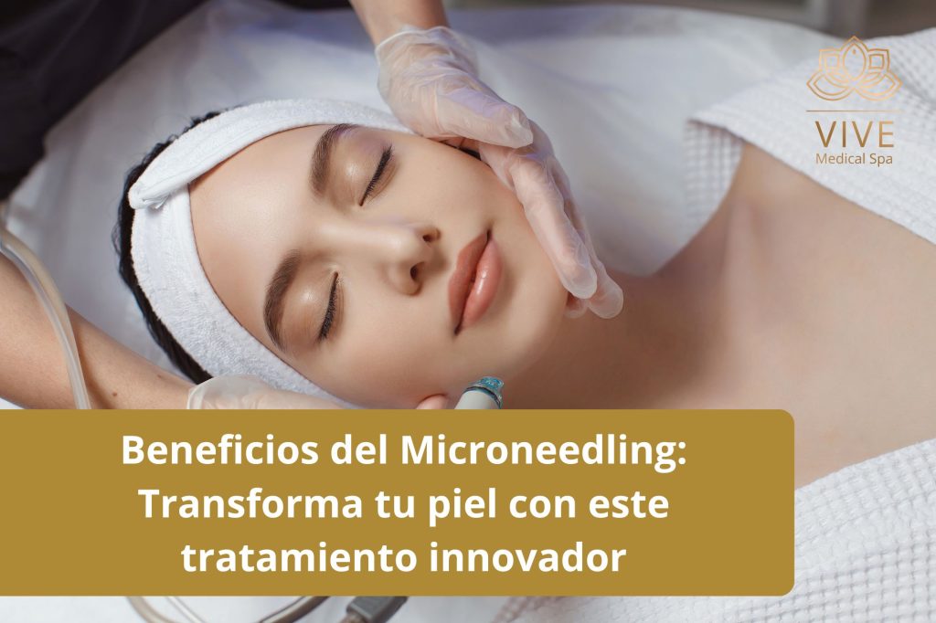 Tratamiento de microneedling en VIVE Medical Spa Tijuana para rejuvenecer la piel