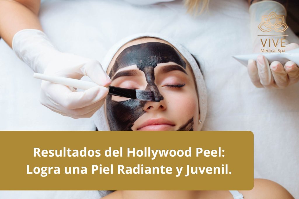 Aplicación del tratamiento Hollywood Peel para una piel más radiante, juvenil y sin imperfecciones en VIVE Medical Spa Tijuana