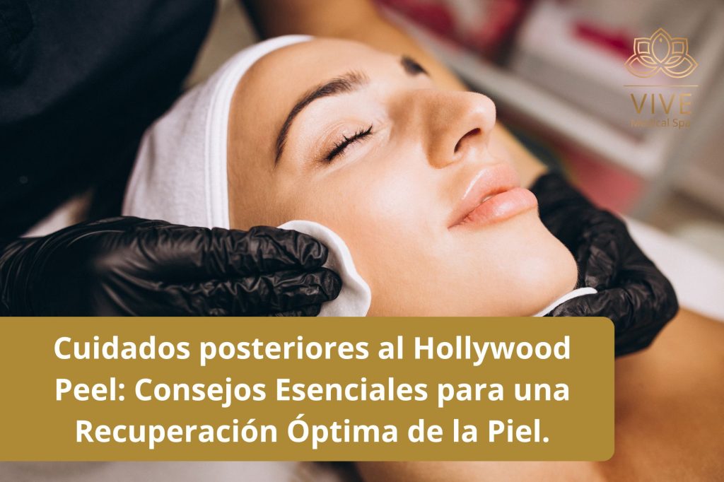 Paciente en VIVE Medical Spa Tijuana recibiendo cuidados posteriores al tratamiento Hollywood Peel para una óptima recuperación de la piel