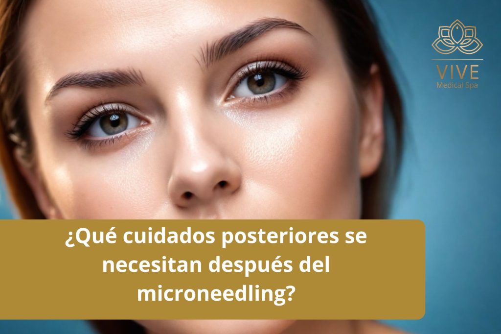 Cuidados posteriores recomendados tras un tratamiento de microneedling en Vive Medical Spa Tijuana.