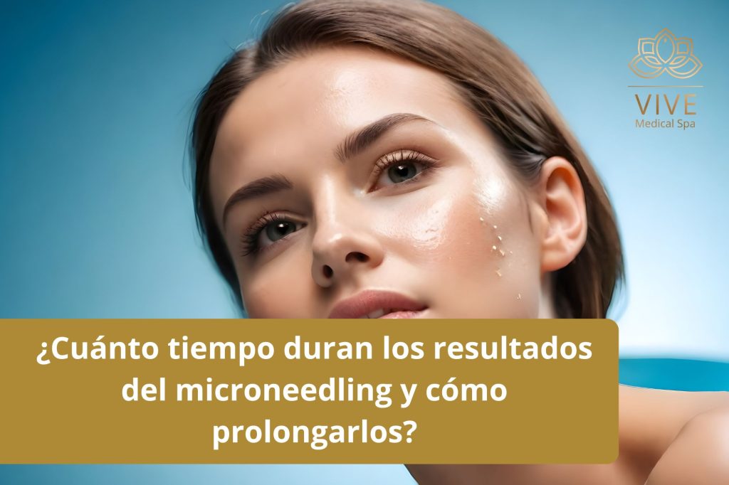 Resultados del tratamiento de microneedling en Vive Medical Spa Tijuana y consejos para prolongar sus beneficios.