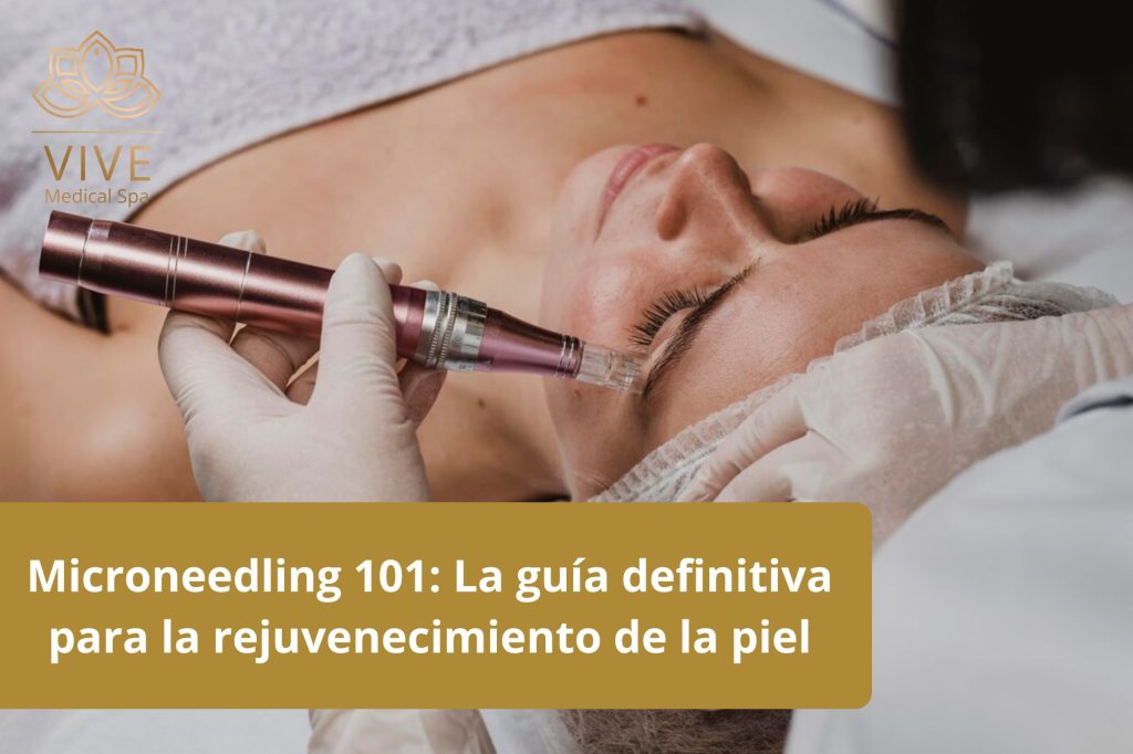 Tratamiento de microneedling en VIVE Medical Spa - Rejuvenecimiento facial y regeneración de la piel en Tijuana
