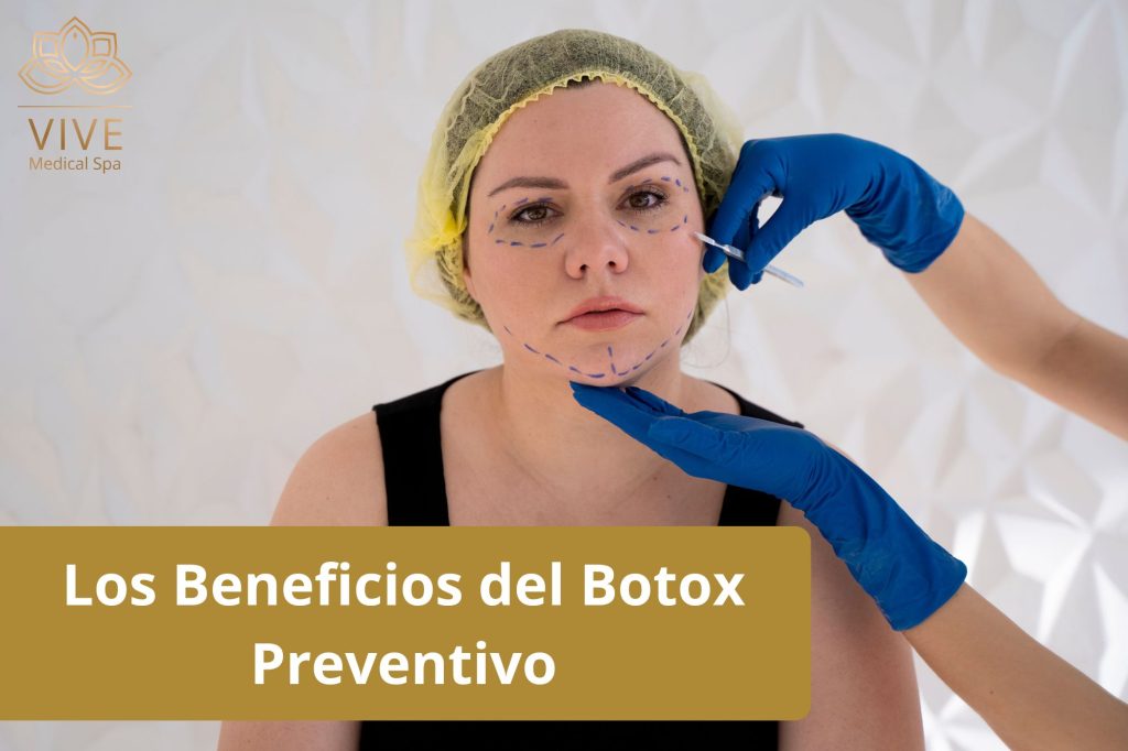 Botox Preventivo: La Clave para Evitar Arrugas y Mantener una Piel Joven - Vive Spa Medico Tijuana Mexico