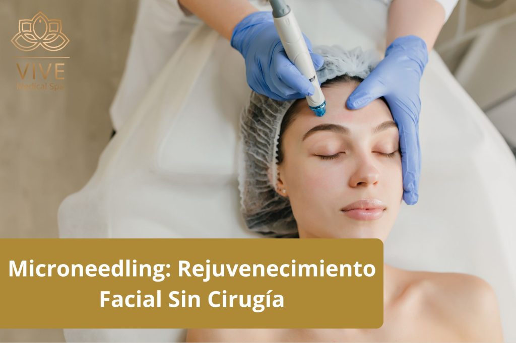 Microneedling en VIVE Spa Médico: Rejuvenecimiento facial sin cirugí