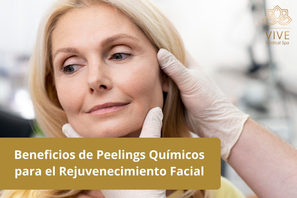 Beneficios de los peelings químicos para el rejuvenecimiento facial en VIVE Spa Médico Tijuana - Tratamiento para una piel más luminosa y firme.