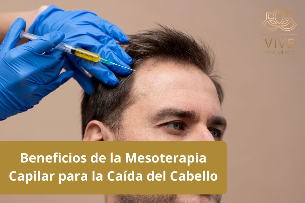 Mesoterapia capilar en VIVE Spa Médico Tijuana - Tratamiento efectivo para fortalecer el cabello y prevenir la caída.