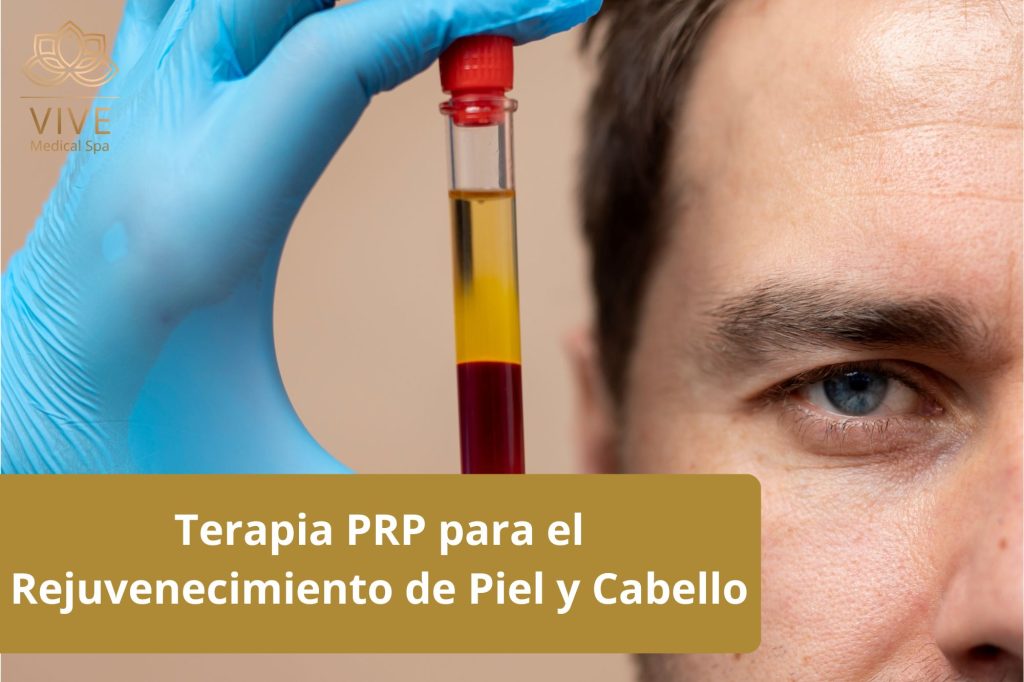 Terapia PRP en VIVE Spa Médico Tijuana - Tratamiento de Plasma Rico en Plaquetas para rejuvenecimiento facial y crecimiento capilar.