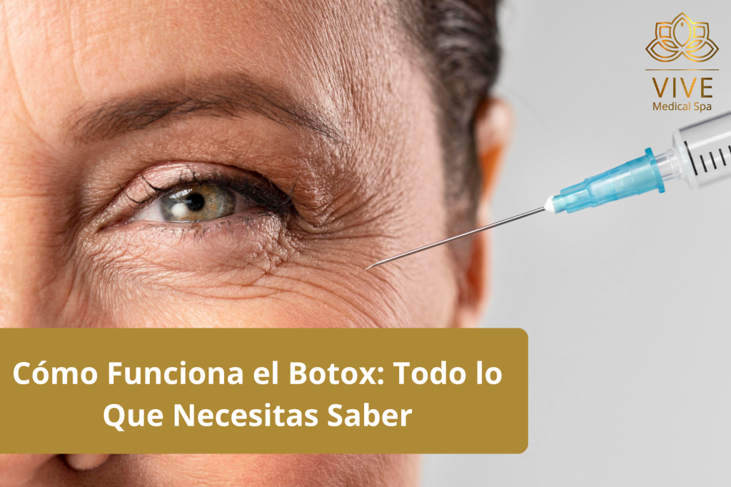 Primer plano de una mujer mayor recibiendo una inyección de Botox cerca del ojo, mostrando cómo funciona este tratamiento para reducir arrugas.
