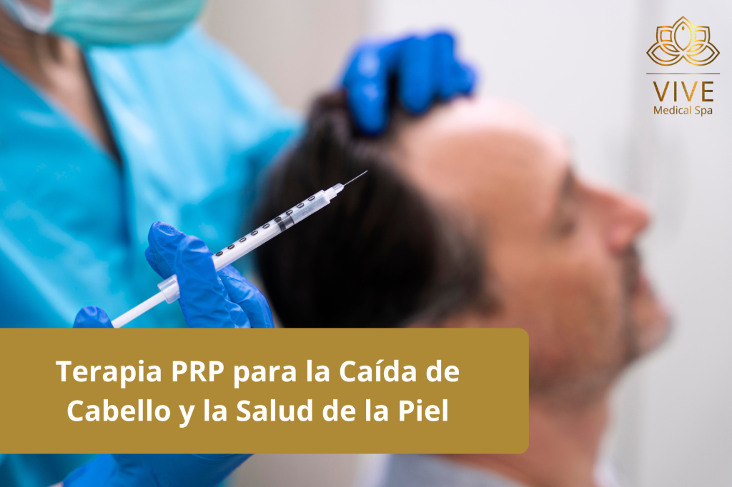 Aplicación de Terapia PRP para combatir la caída del cabello y mejorar la salud de la piel en Vive Medical Spa, Tijuana