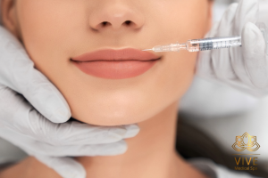 Aplicación de relleno de labios en VIVE Medical Spa Tijuana