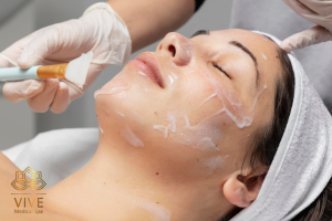 Aplicación de mascarilla facial en VIVE Medical Spa Tijuana