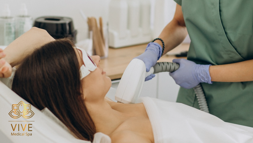 Mujer recibiendo tratamiento de depilación láser en VIVE Medical Spa Tijuana, no es paciente real.